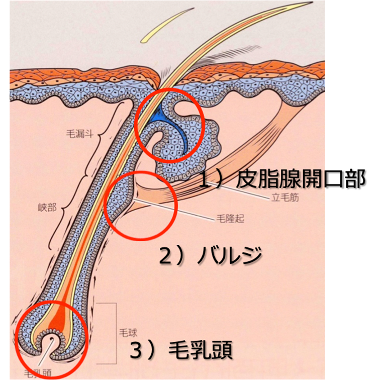 レーザー脱毛の原理